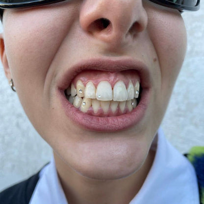 Tooth Gem Starter Kit